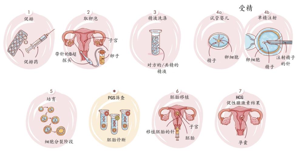 供卵试管婴儿宝宝为什么睡觉前哭闹